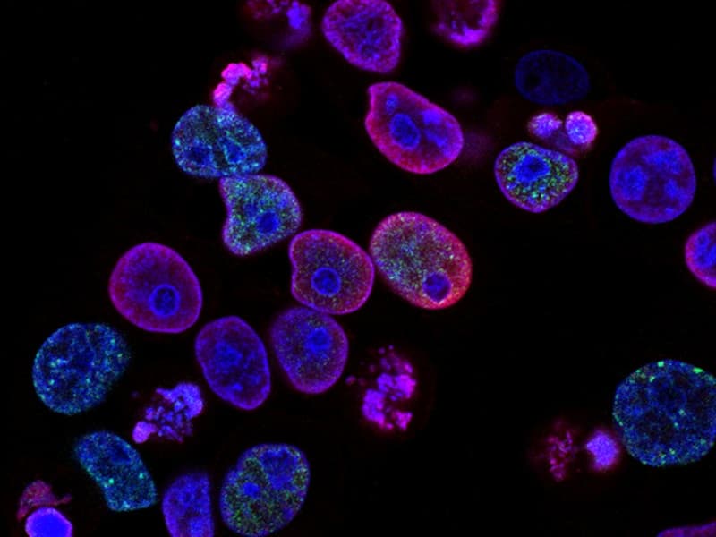 Consultation endocrinologie